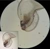 Oniscus asellus